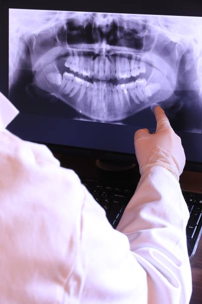 Best Emergency Tooth Extraction in Wyomissing, PA